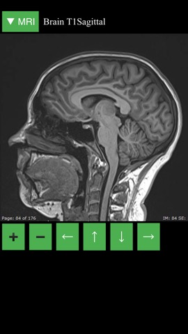 MRI Viewerのおすすめ画像2