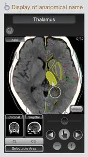 ct passport head problems & solutions and troubleshooting guide - 1