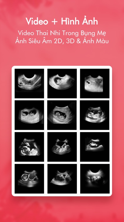 Bà Bầu ~ 280 Ngày Mang Thai