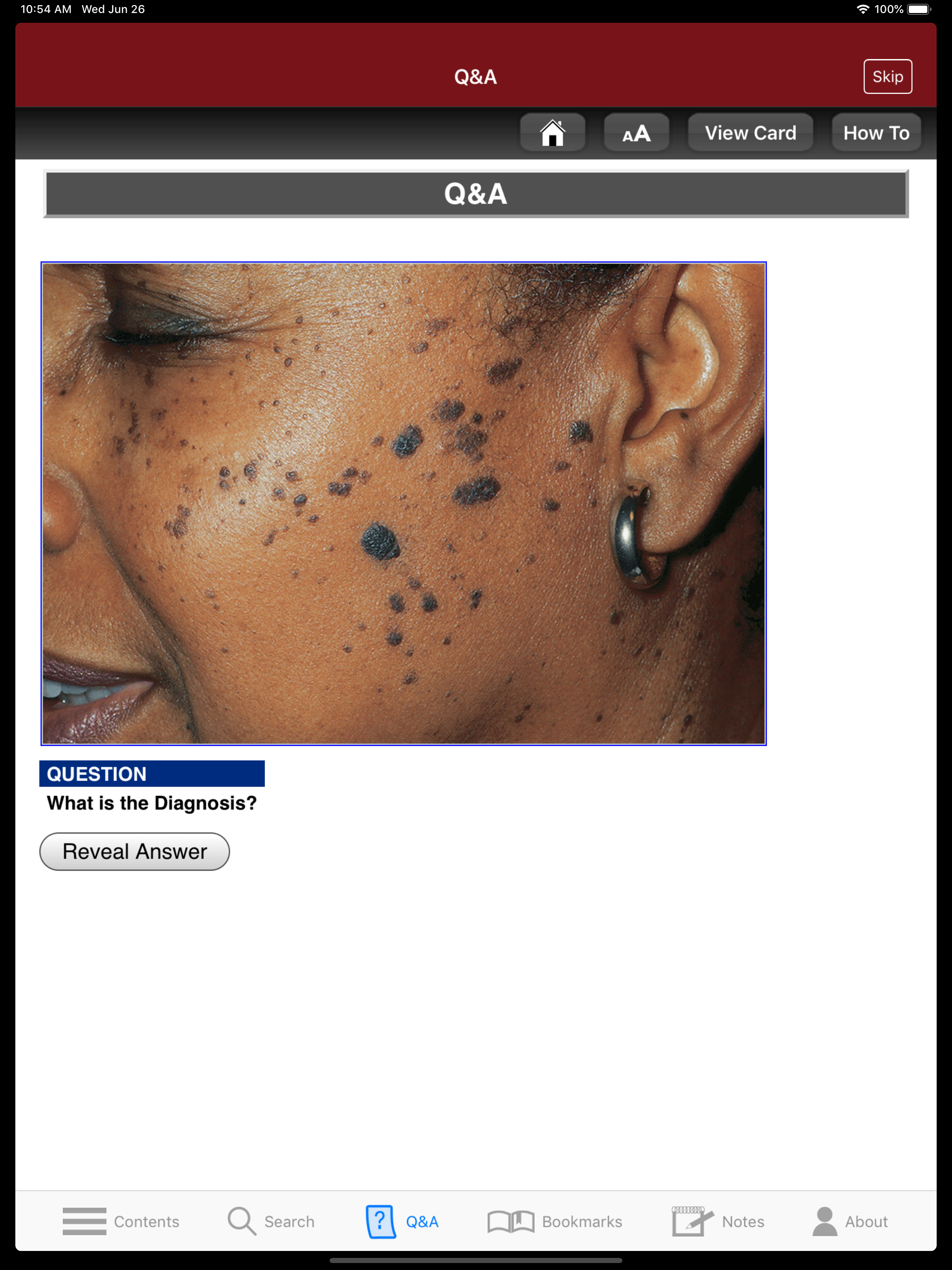 Fitzpatrick's Derm Flash Cards