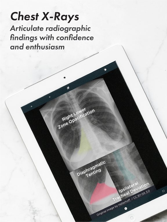 Screenshot #6 pour USMLE Clinic