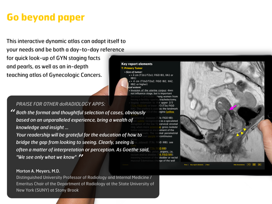 Screenshot #5 pour Gyn Cancer Staging Atlas