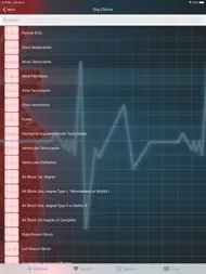 EKG Clinical ipad bilder 1