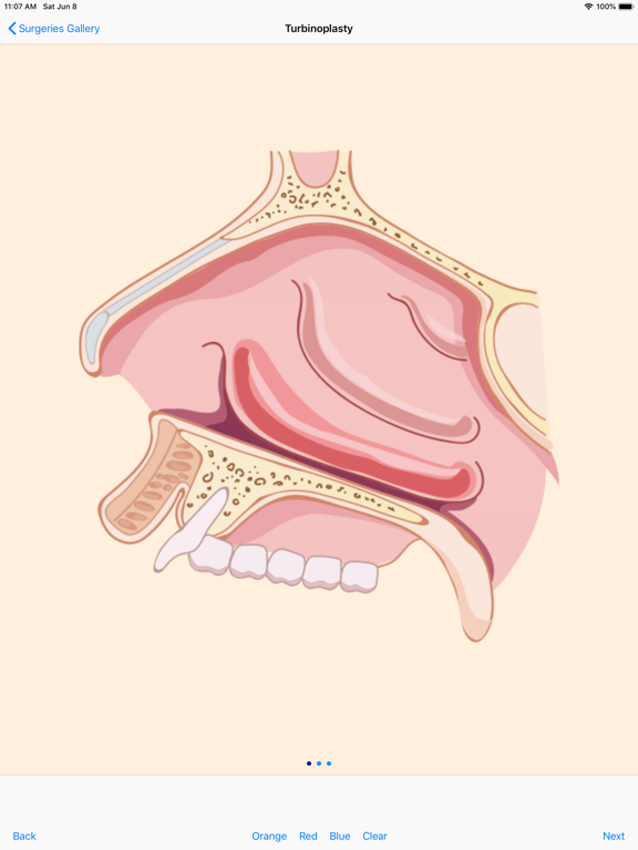 Screenshot #6 pour SeeENT