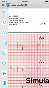 Norav Medical Mobile ECG screenshot