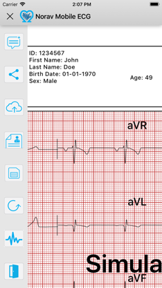 Norav Medical Mobile ECG screenshot 5