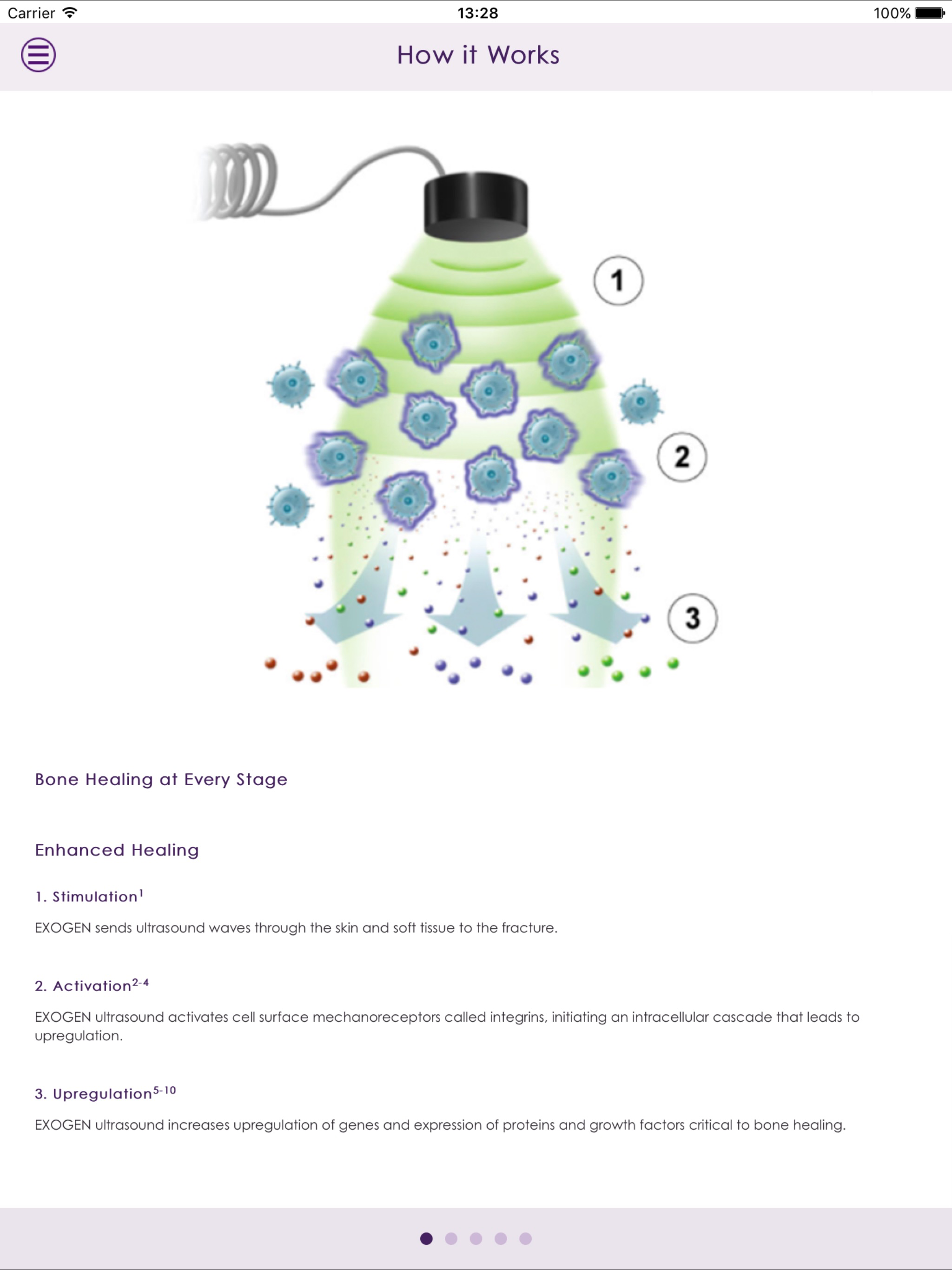 EXOGEN Connects