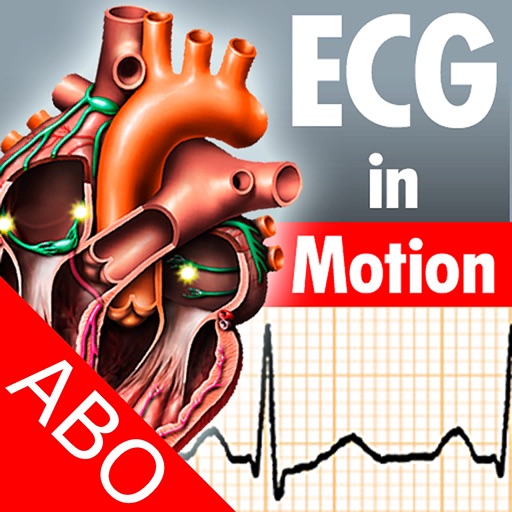 ECGinMotion Abo