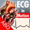 ECG in Motion – a view of the beating heart