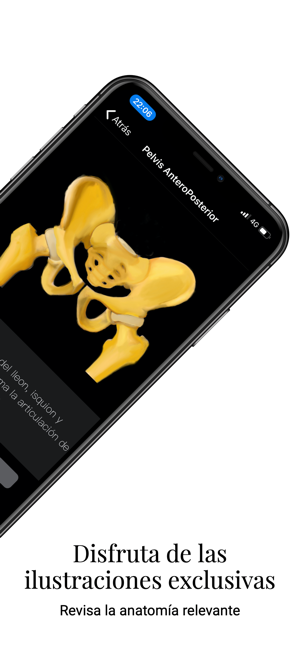 XRay Assistant(圖2)-速報App