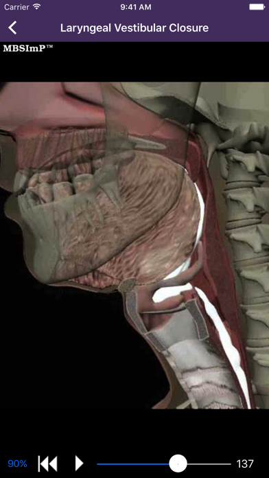 Dysphagia Screenshot