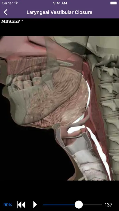 Dysphagia screenshot 4 of 5