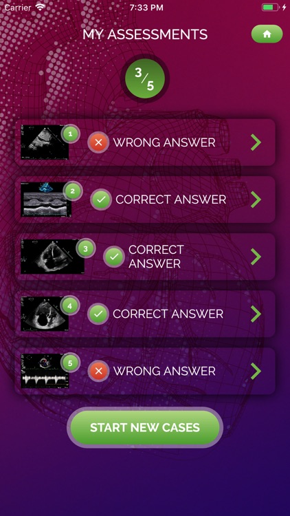 EchoRight screenshot-4
