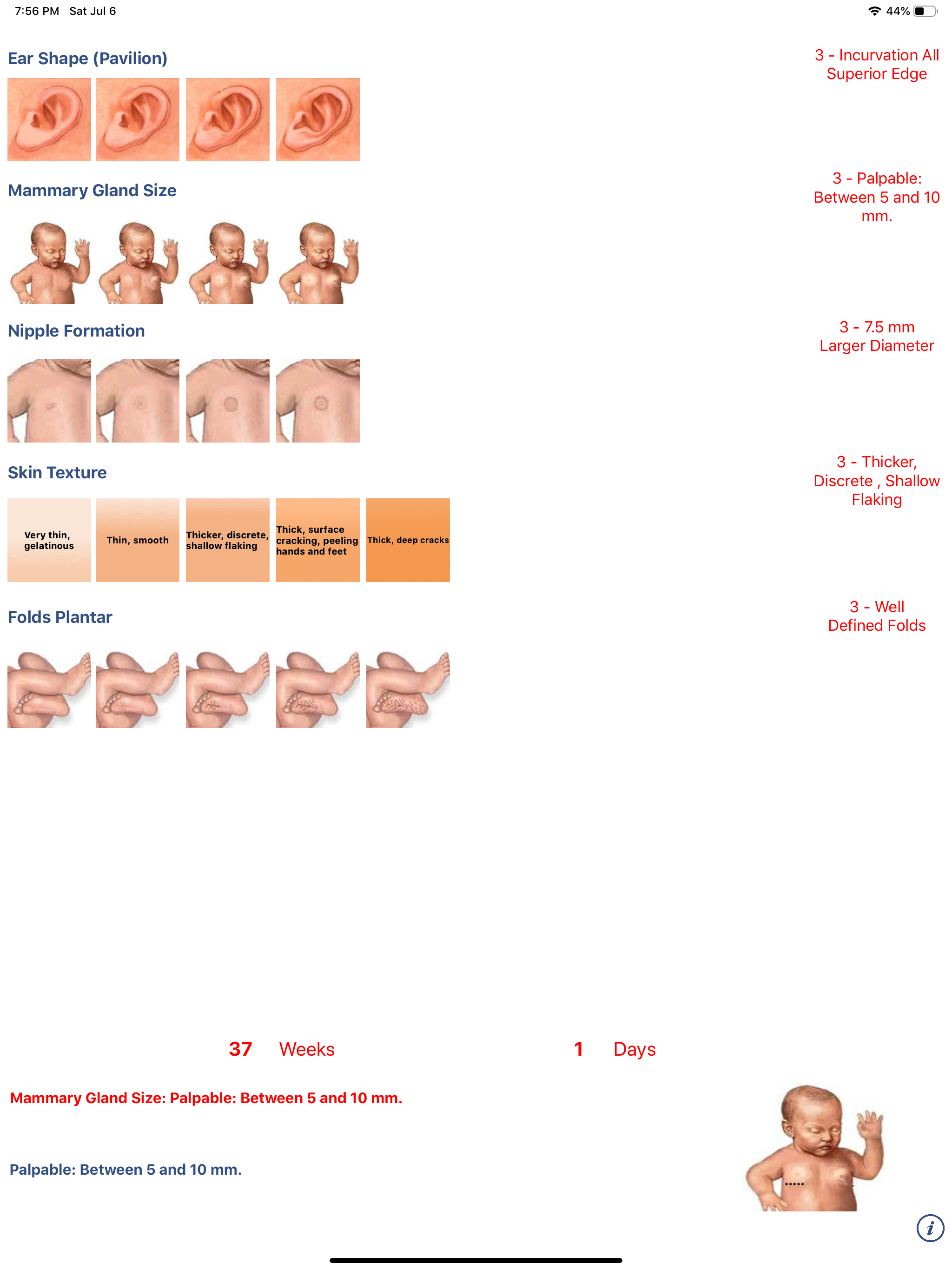 Neonatology: Test Capurro screenshot 8
