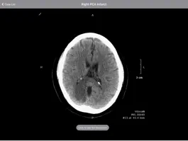 Game screenshot Radiology 2.0: Head CTs mod apk
