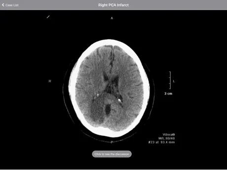 Radiology 2.0: Head CTs