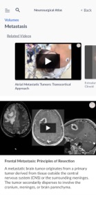 Neurosurgical Atlas screenshot #3 for iPhone