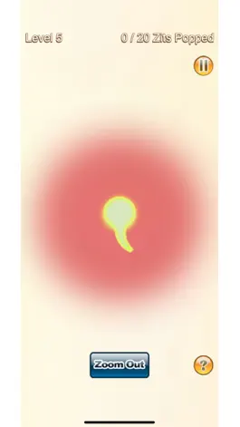 Game screenshot Pimple Popper hack