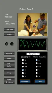 How to cancel & delete ecg rhythms and acls cases 3