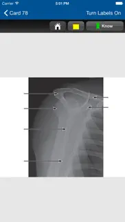radiographic positioning cards iphone screenshot 4