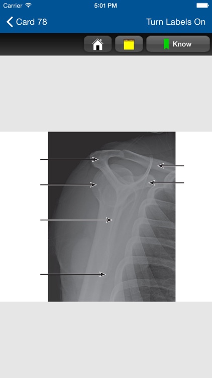Radiographic Positioning Cards screenshot-3