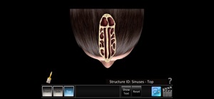 Sinus ID screenshot #3 for iPhone