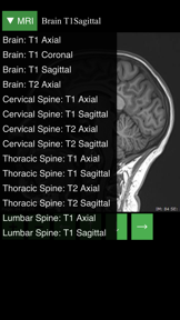 MRI Viewer screenshot