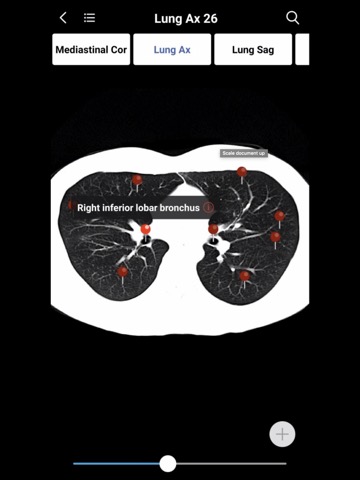 MedImaging-Radiology Made Easyのおすすめ画像6