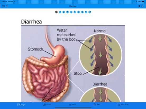 Diarrhea iPad screenshot