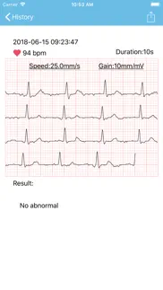 mini ecg problems & solutions and troubleshooting guide - 3