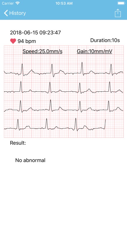 mini ECG screenshot-3