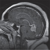 Neuroscience Lippincotts Illustrated QA Review