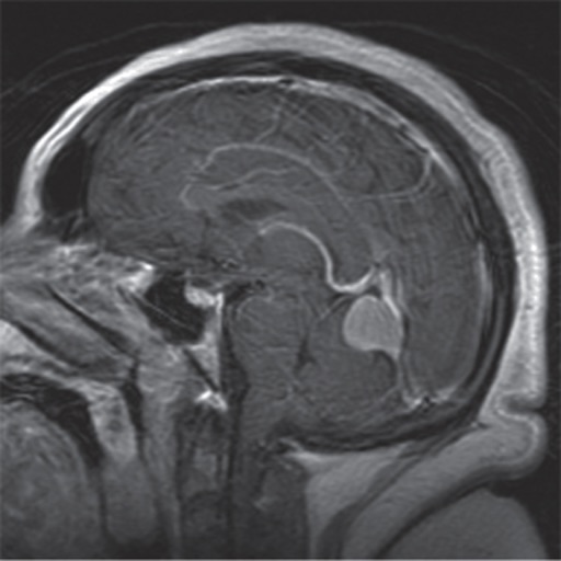 Neuroscience Lippincott's Illustrated Q&A Review