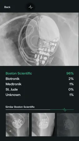 Pacemaker-ID screenshot 3