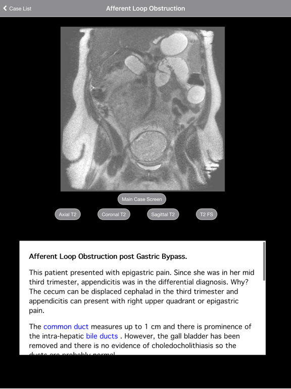 Pregnant Appendicitis iPad screenshot 4 - Medical app