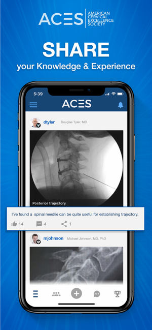 ACES – Cervical Fusion Forum(圖3)-速報App