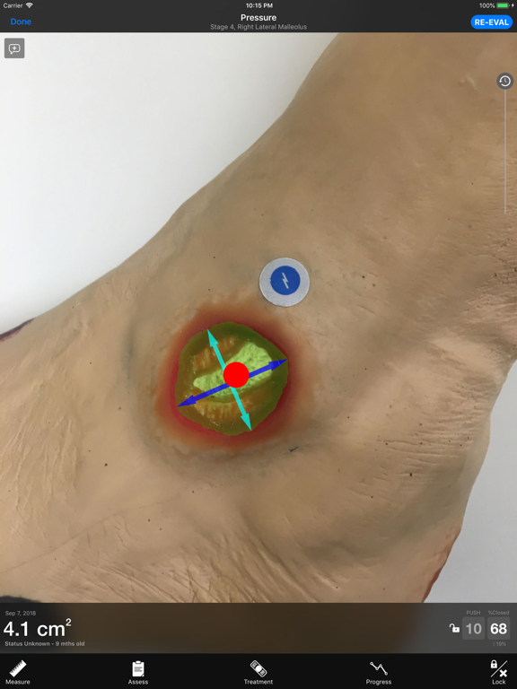 Swift Skin and Wound Training iPad screenshot 2 - Medical app