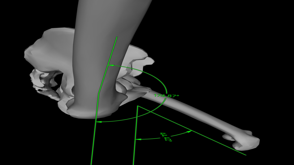 #6. HarnessARapp (iOS) 由: ORTHOPRACTIS.COM SINGLE MEMBER P.C.
