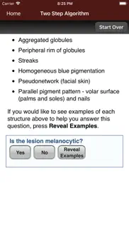 How to cancel & delete dermoscopy two step algorithm 3