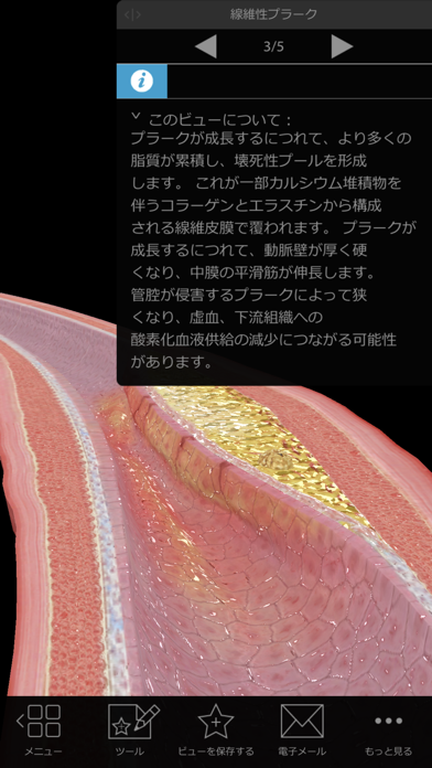 生理学と病理学スクリーンショット