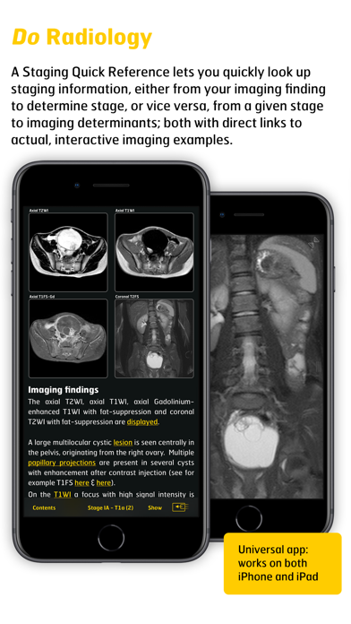 Screenshot #3 pour Gyn Cancer Staging Atlas