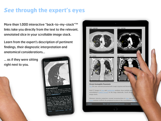 Radiology - Thoracic Imaging iPad app afbeelding 4