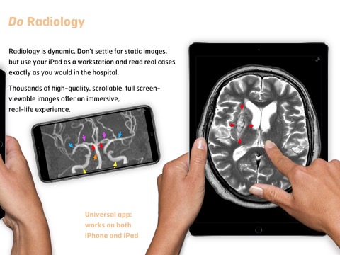 Radiology - Imaging in Strokeのおすすめ画像3