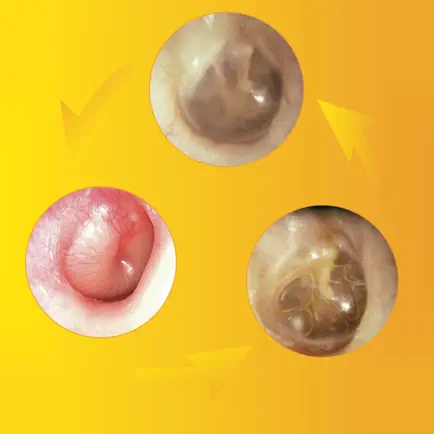 Otoscopia e Otites RA Читы