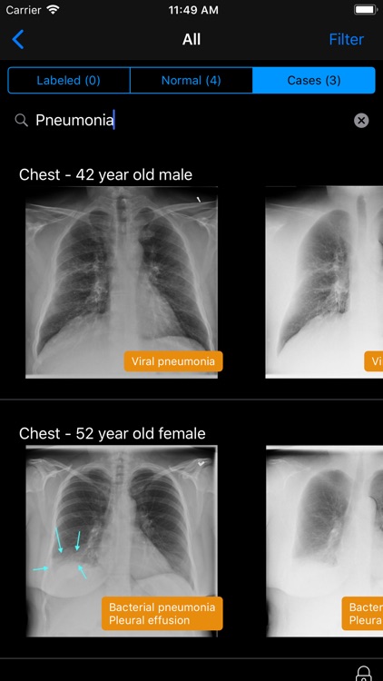 Normal X-Rays and Real Cases