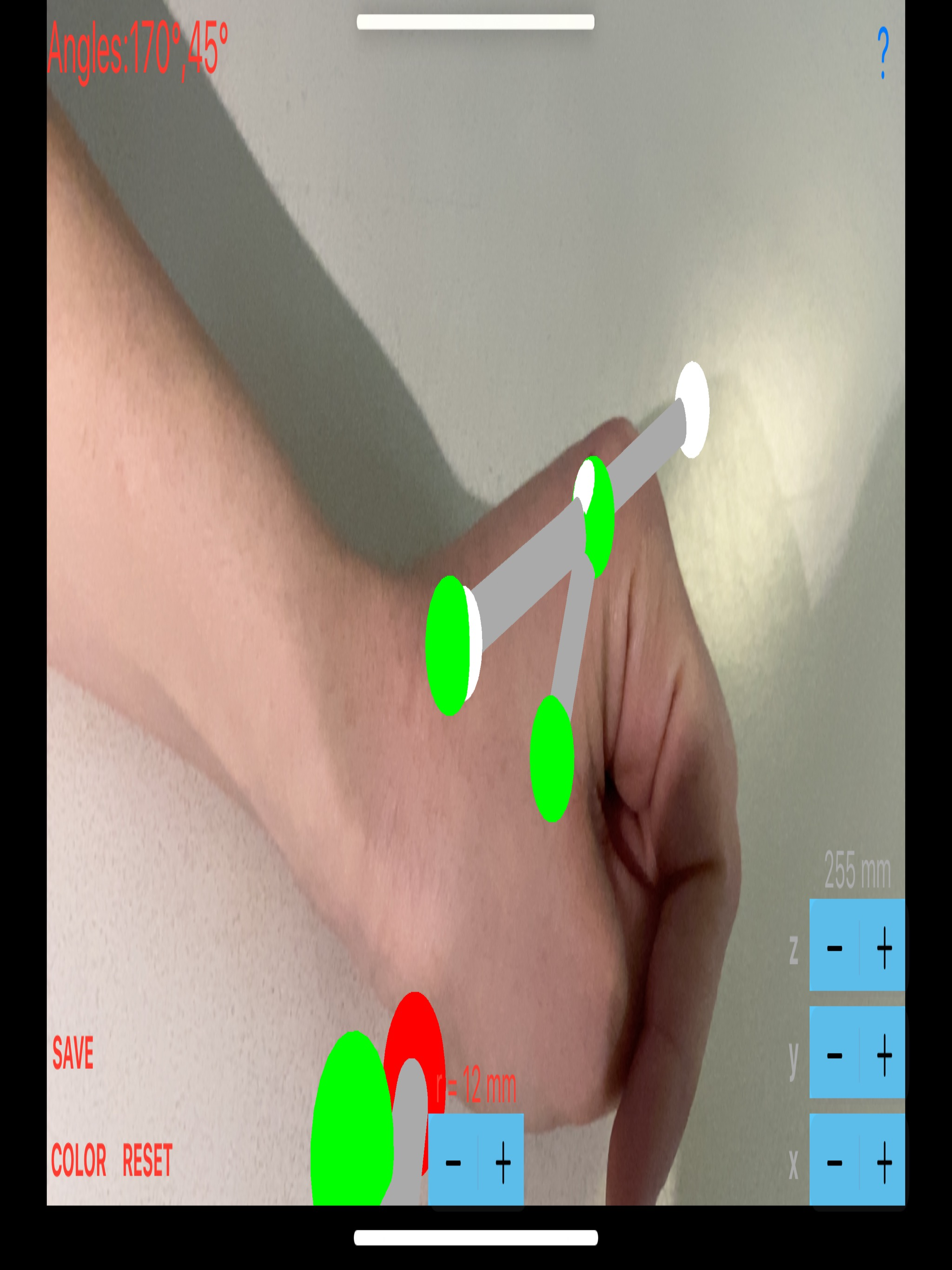 ARorthopaedicGoniometer screenshot 15