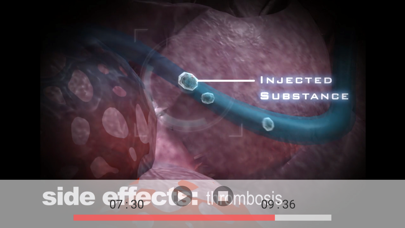 Screenshot #3 pour Ice - Your Body Belongs to You