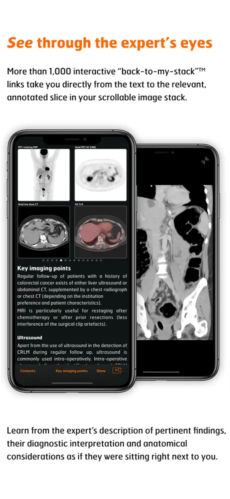 Radiology - CRC Staging Atlas