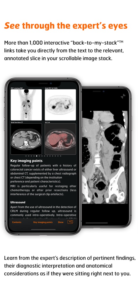 Radiology - CRC Staging Atlas - Medical App | MWM