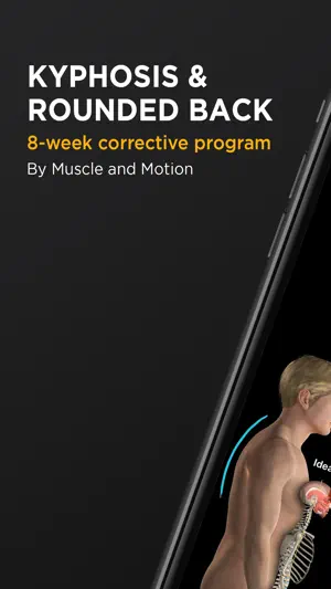 Muscle & Motion: Kyphosis screenshot 1